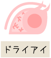 ドライアイ