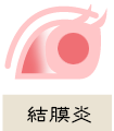 結膜炎